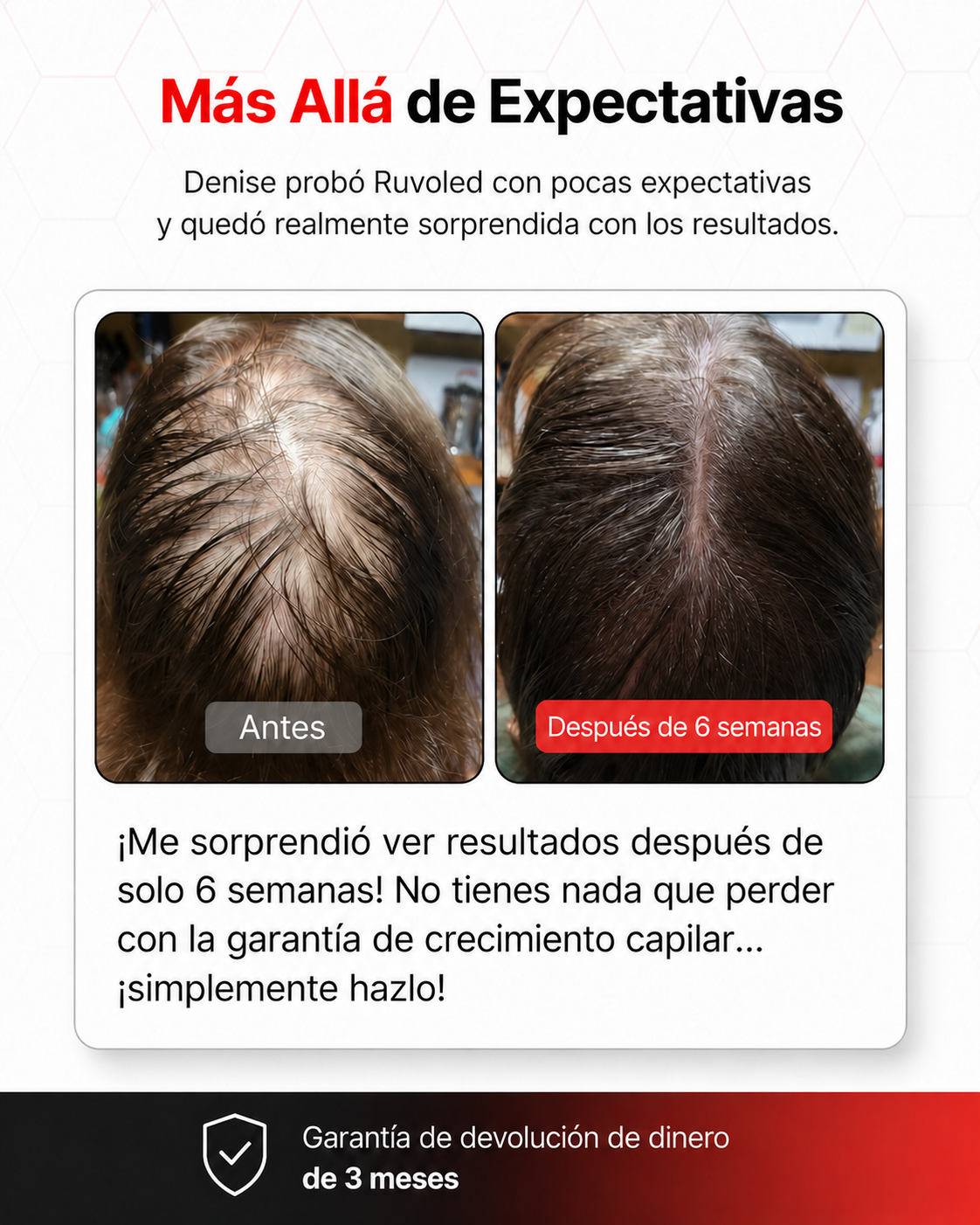 Ruvoled Pro · Gorra de Fototerapia LED para Regeneración Capilar
