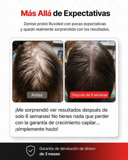 Ruvoled Pro · Gorra de Fototerapia LED para Regeneración Capilar