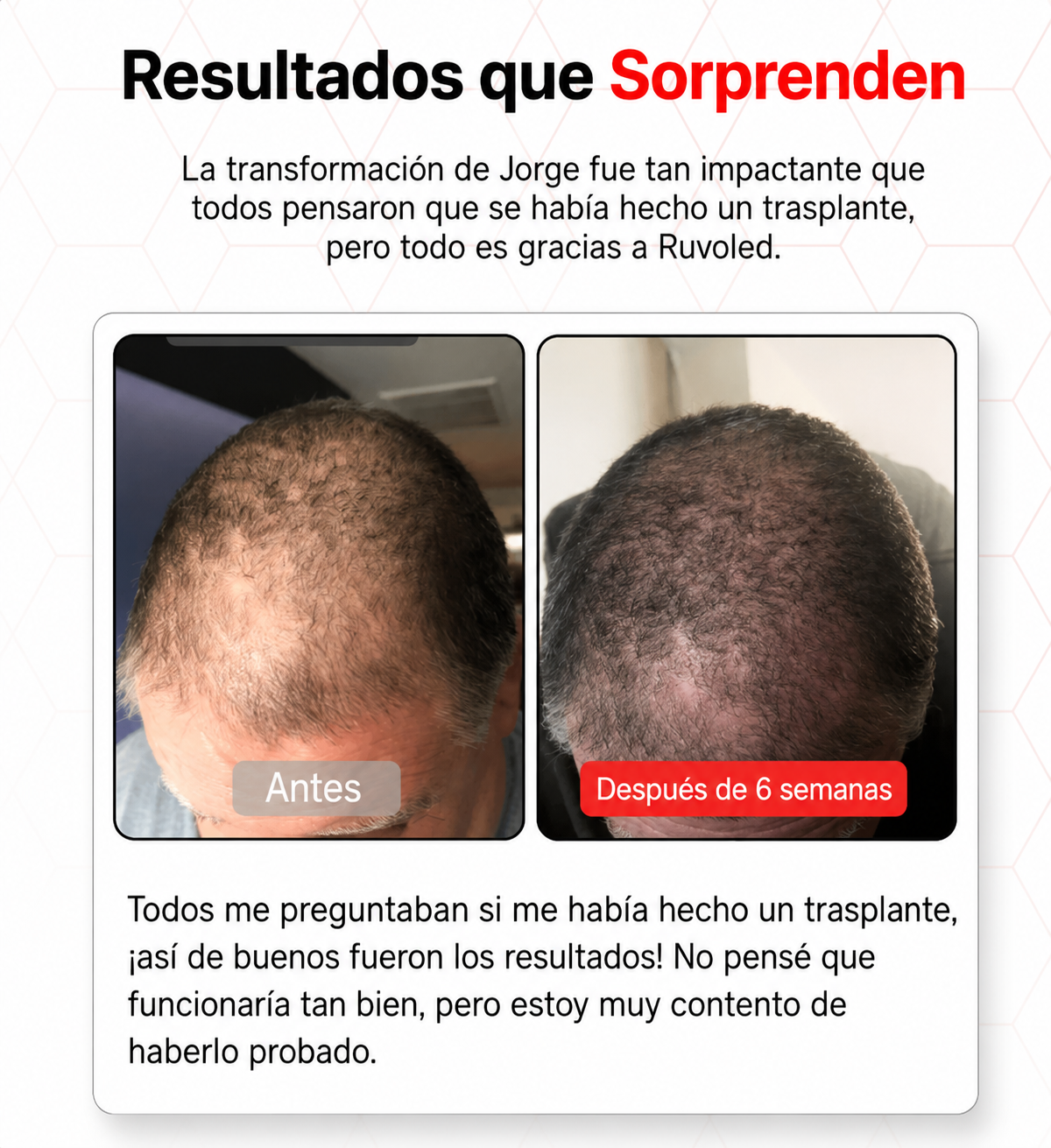 Ruvoled Pro · Gorra de Fototerapia LED para Regeneración Capilar