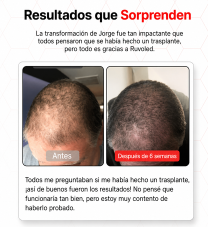 Ruvoled Pro · Gorra de Fototerapia LED para Regeneración Capilar