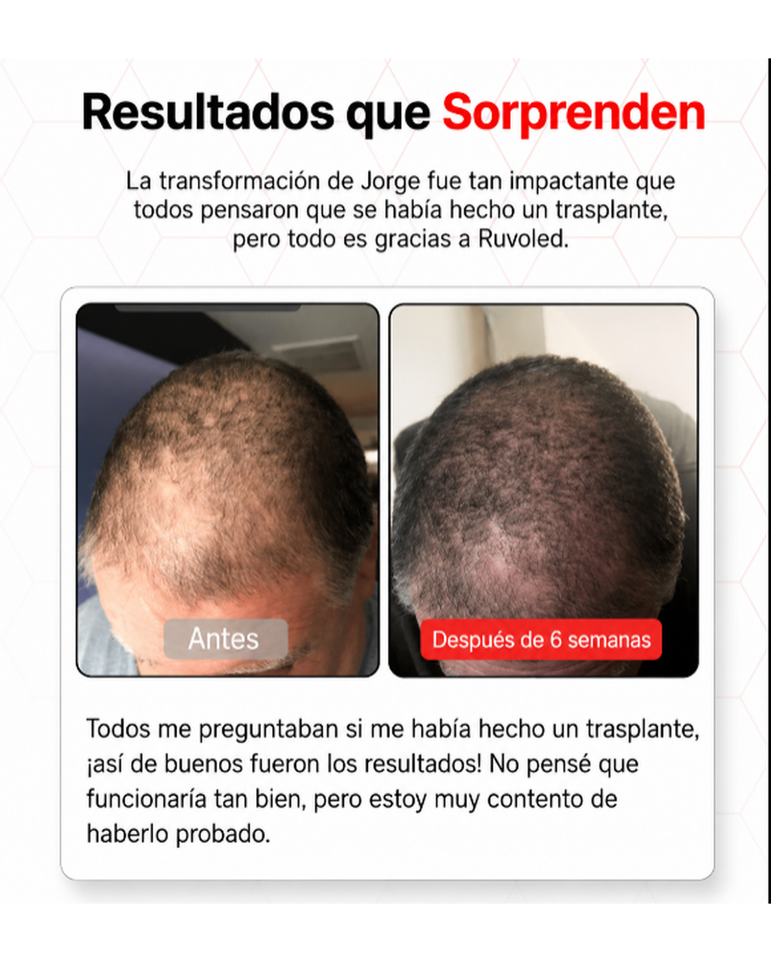 Ruvoled Pro · Gorra de Fototerapia LED para Regeneración Capilar